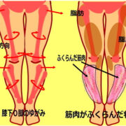 膝下O脚　膝下のふくらみ 180x180 - 骨盤の横幅が広い 大転子が出っ張っている人の特徴
